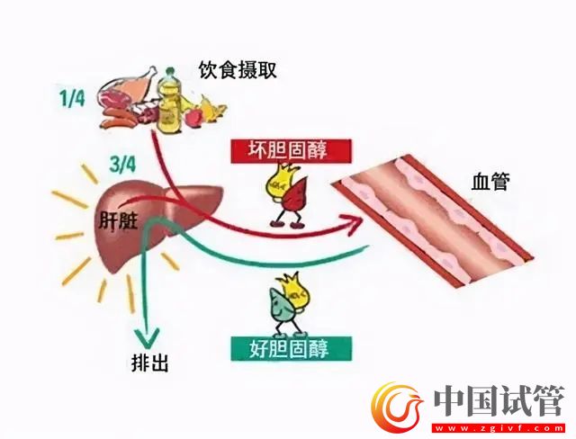 首款针对“坏胆固醇”的口服药问世(图1)