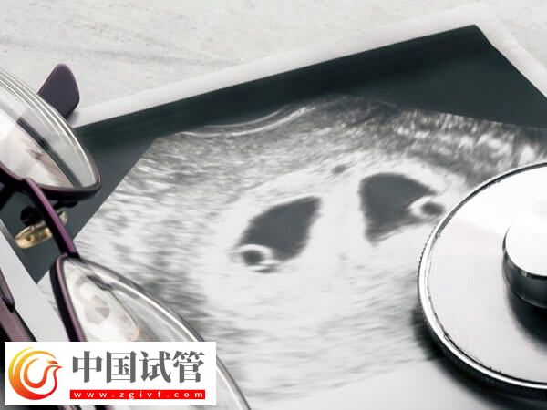 残角子宫助孕选成都哪家医院好？对比成功率选更放心(图2)
