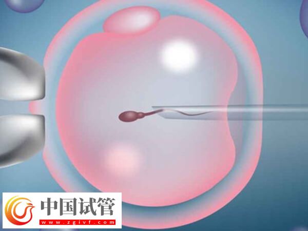 49岁高龄做试管婴儿易生化，染色体异常是主要原因(图2)
