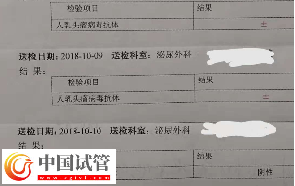 通过hpv报告单图片怎么判断自己是正常的呢？(图2)