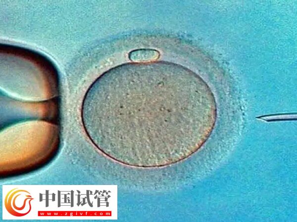 广州市第一人民医院试管婴儿价格，养囊4千起(图1)
