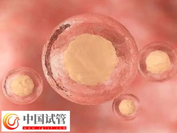 试管婴儿是不是取卵越多越好(图1)