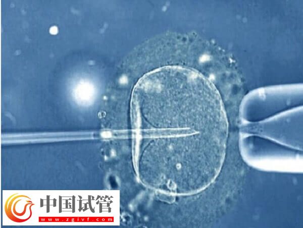 三代试管移植成功了要注意什么(图2)