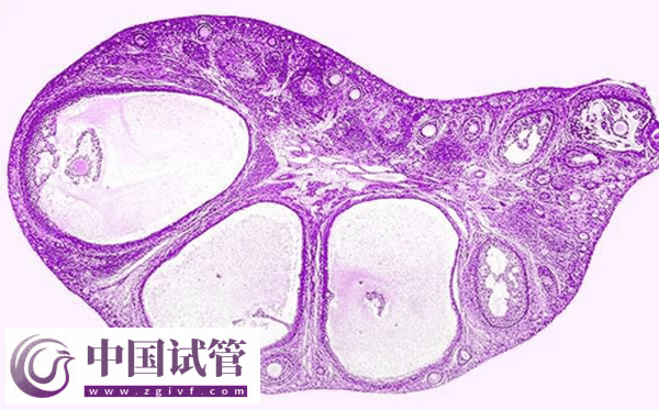 河南省人民医院做试管婴要准备什么(图3)