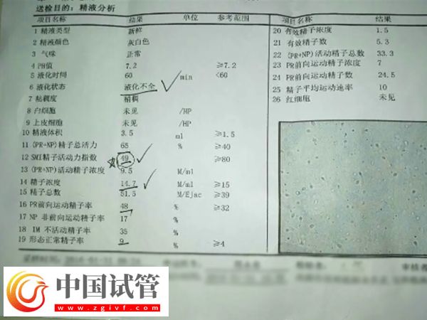 河南省人民医院做试管婴要准备什么(图2)