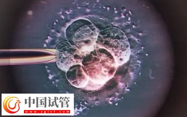 移植一个冻胚8c2成功率高不高(图1)