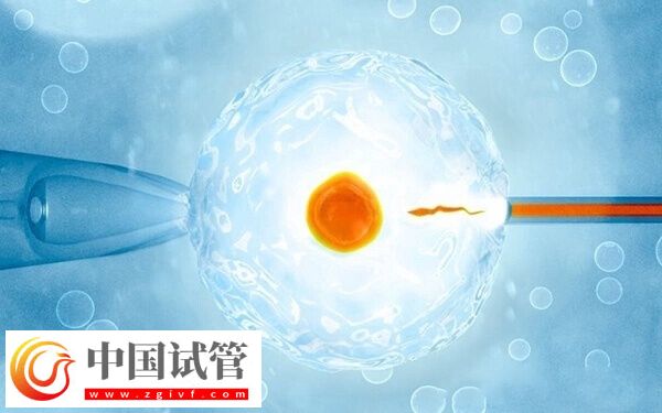 做试管婴儿为什么要降糖(图1)