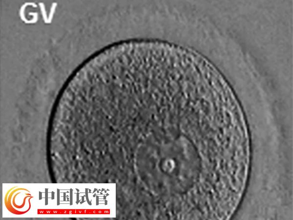 女性FSH高怎样才能降下来(图2)