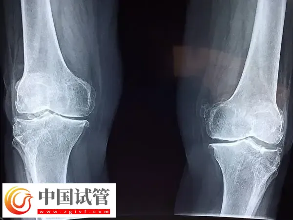 女性FSH高怎样才能降下来(图3)