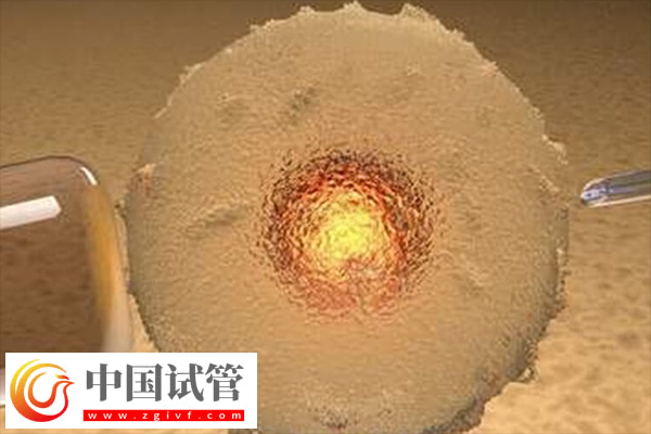 前往俄罗斯做试管合不合法(图1)
