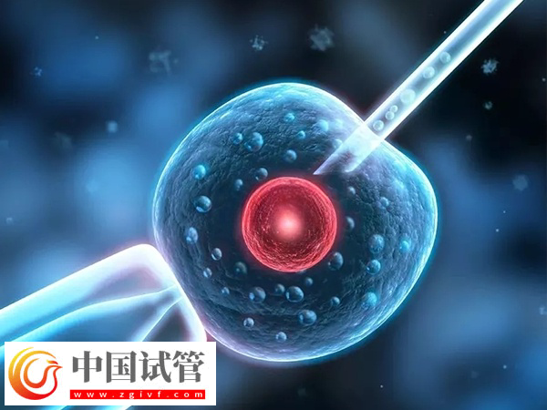 前往俄罗斯做试管合不合法(图2)