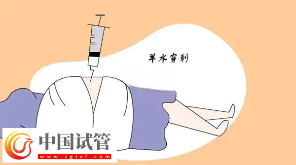 申请供精试管怀孕必须要查羊穿(图1)