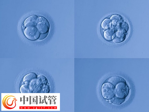 试管婴儿fet移植成功率是多少(图1)