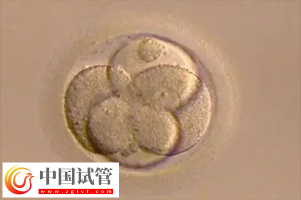 试管原肠胚能不能进行胚胎移植手术(图1)