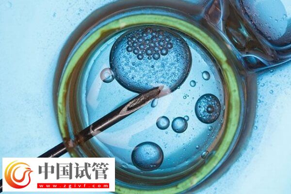 做试管对amh值有没有要求(图1)