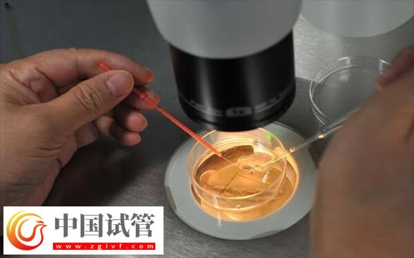 为什么医生不给移植鲜胚(图1)