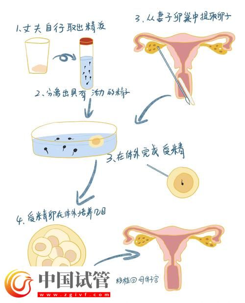 试管婴儿的孕卵发育过程详解(图2) 试管婴儿的孕卵发育过程详解(图2)
