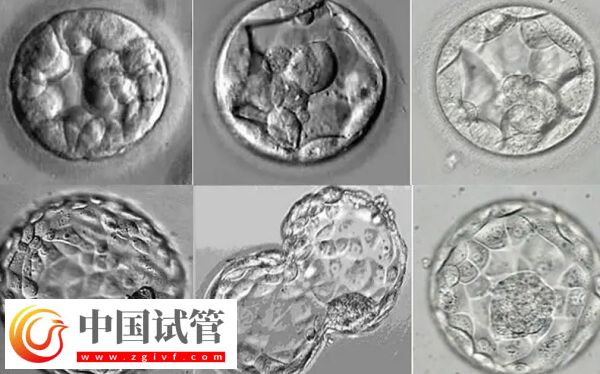 移植囊胚容易变成双胞胎是怎么回事(图1)