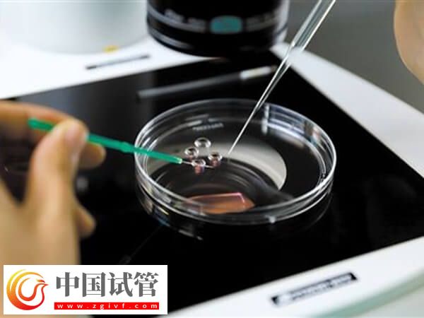 精子活力低做试管怎么办(图2)