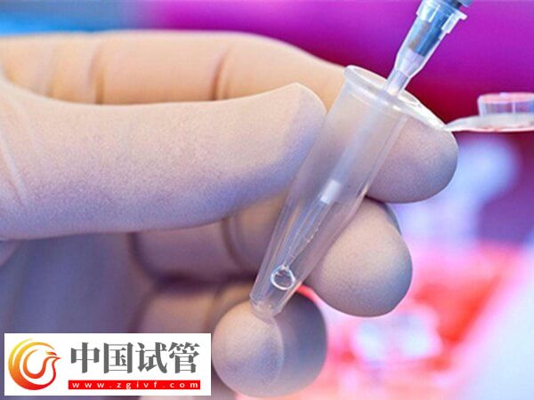 试管婴儿哪个步骤最疼(图3)