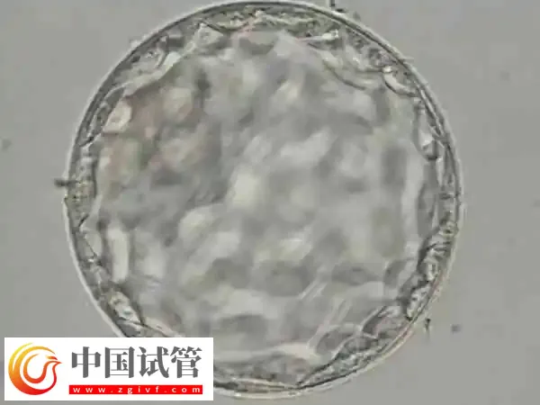 怎么判断试管移植成功与否(图1)