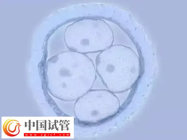 胚胎移植第11天肚子刺疼怎么回事(图1)