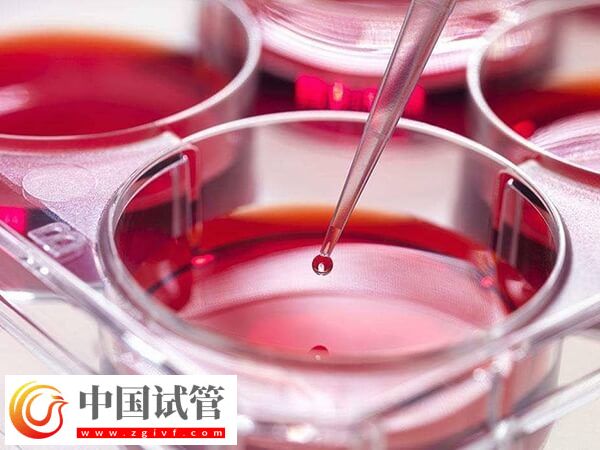 移植后如何知道胚胎着床了(图1)