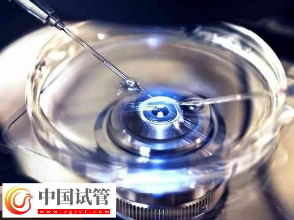 取卵后饮食安排要有数，可以吃什么不能吃什么食物看完知(图1)