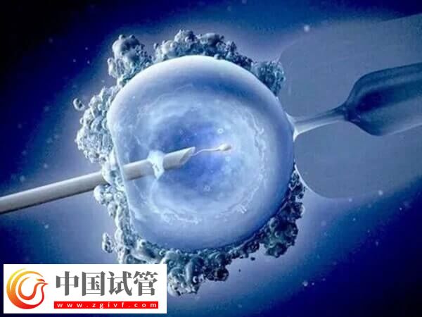 试管婴儿CET和FET是什么意思(图2)