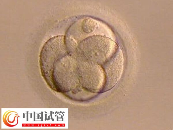 试管婴儿移植前胚胎如何评分(图1)