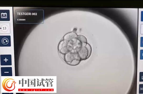做二代试管为什么老配成c级胚胎(图1)