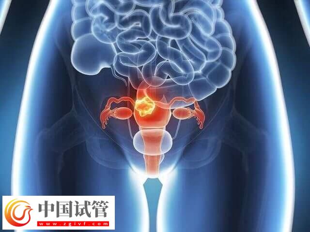 促排卵泡少可不可以降调(图2)