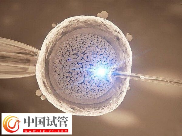成都做试管婴儿哪家好(图3)
