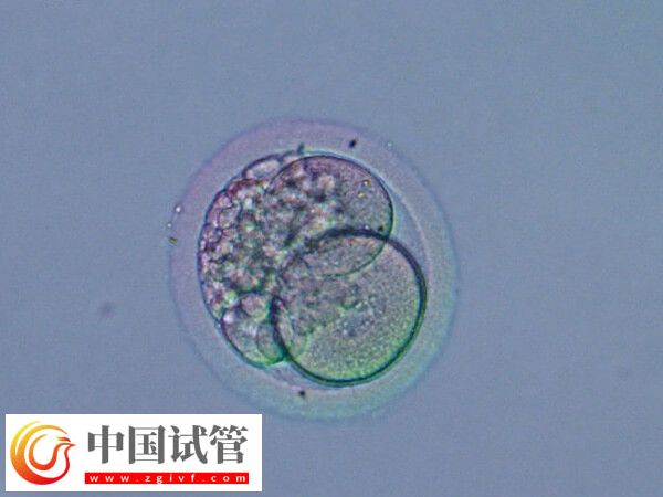 移植囊胚是不是容易生下双胞胎(图2)