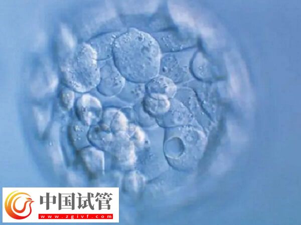 30岁促卵泡刺激素100多是怎么回事(图2)