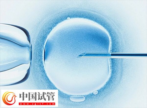 广州能生男孩的试管医院有哪些(图2)
