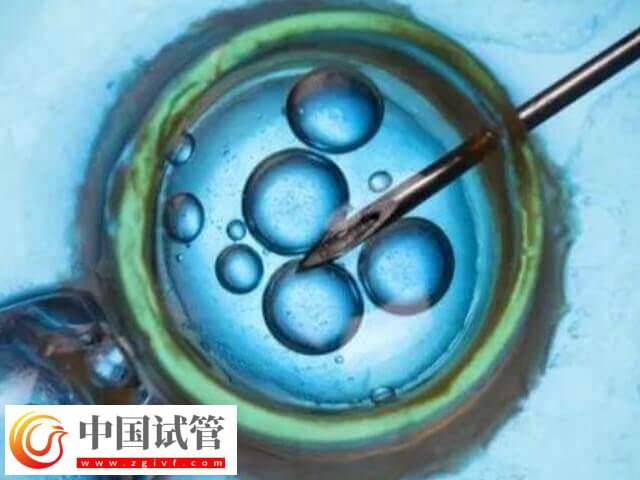 上海试管医院排名前十名(图1)
