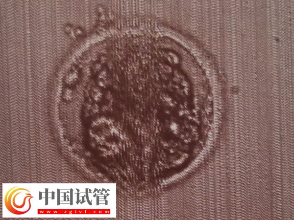 第7天囊胚4Bb有无必要移植(图1)