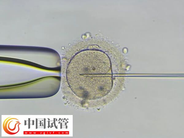 pgs筛查会淘汰多少囊胚(图1)
