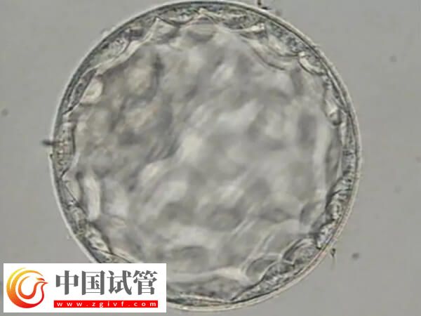 胚胎8细胞三级是不是比5细胞好(图2)