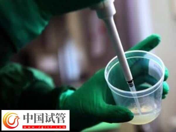 艾滋病洗精费用是多少(图2)
