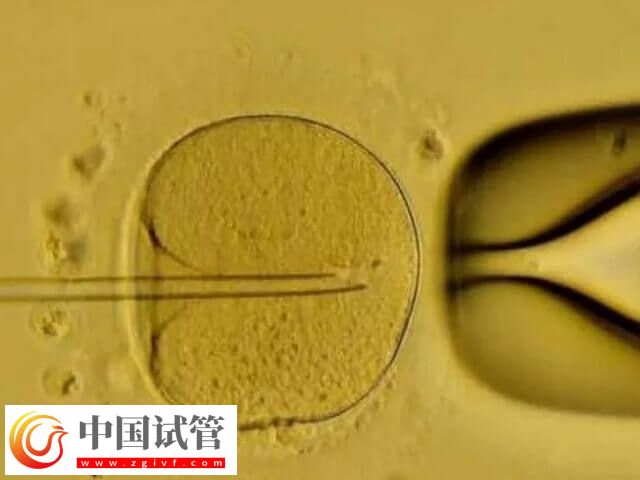 5BB胚胎跟4CC胚胎那个好(图1)