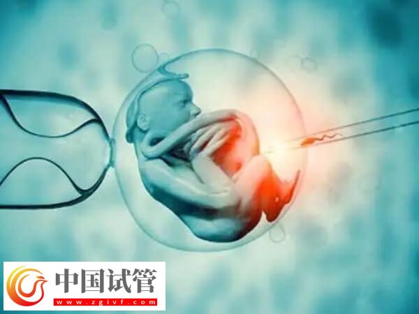 澳门试管成功率高不高(图1)