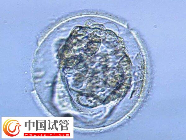 黄体期取卵是不是不可以移植鲜胚(图1)