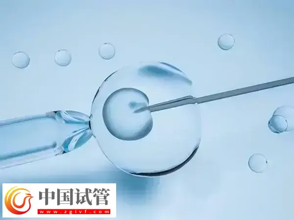 做试管是不是可以提高卵子质量(图1)
