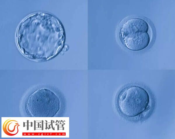 高龄是不是适合养囊胚(图1)