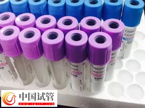 amh低会不会有优势卵泡发育(图1)