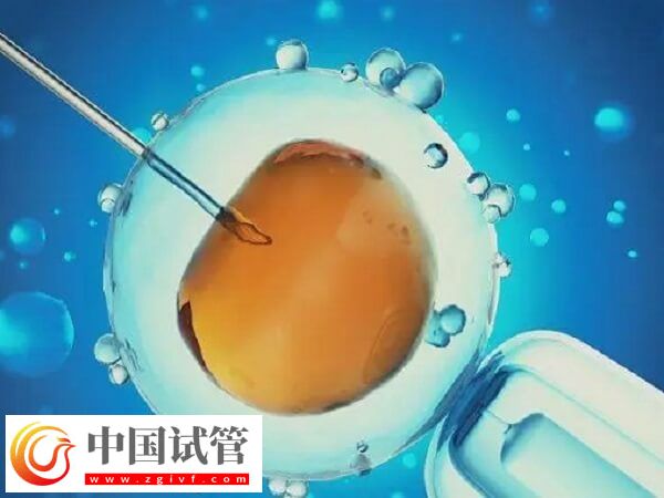 北京和上海做试管哪个技术好(图1)