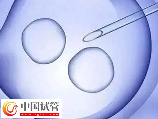广州能不能做HIV试管(图1)