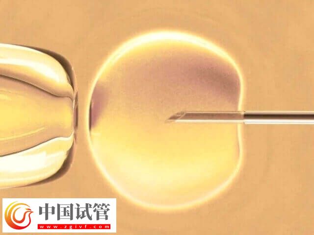 广州哪里可以做试管三代(图1)